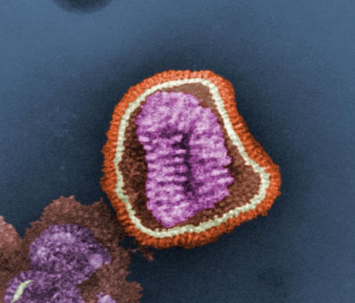 1402px-Influenza_virus_particle_color
